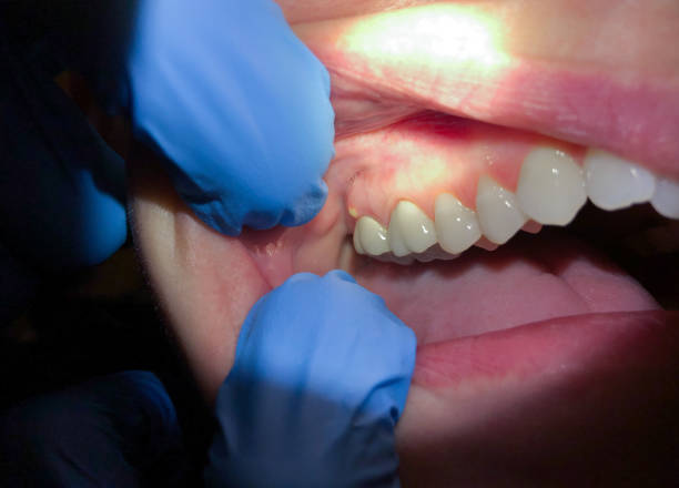 Best Emergency Dental Surgery in Old Stine, CA